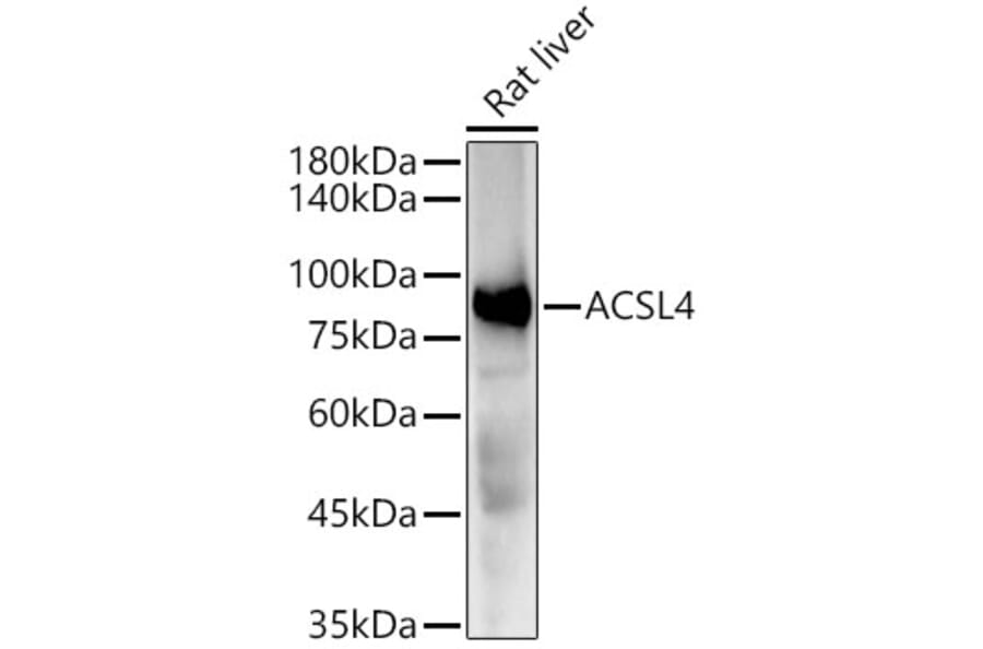 Western Blot - Anti-FACL4 Antibody [ARC53209] (A306923) - Antibodies.com