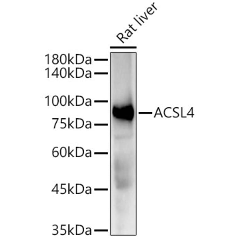 Western Blot - Anti-FACL4 Antibody [ARC53209] (A306923) - Antibodies.com