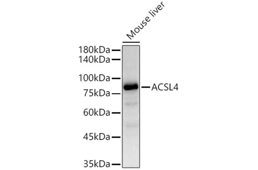 Western Blot - Anti-FACL4 Antibody [ARC53209] (A306923) - Antibodies.com
