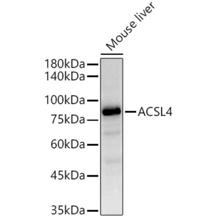 Western Blot - Anti-FACL4 Antibody [ARC53209] (A306923) - Antibodies.com