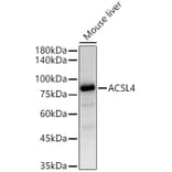 Western Blot - Anti-FACL4 Antibody [ARC53209] (A306923) - Antibodies.com