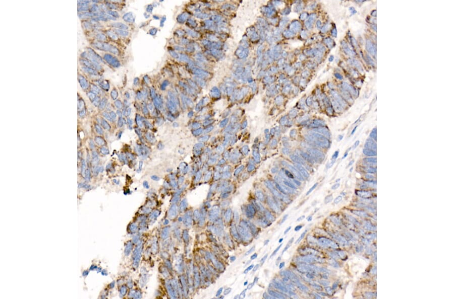Immunohistochemistry - Anti-FACL4 Antibody [ARC53209] (A306923) - Antibodies.com