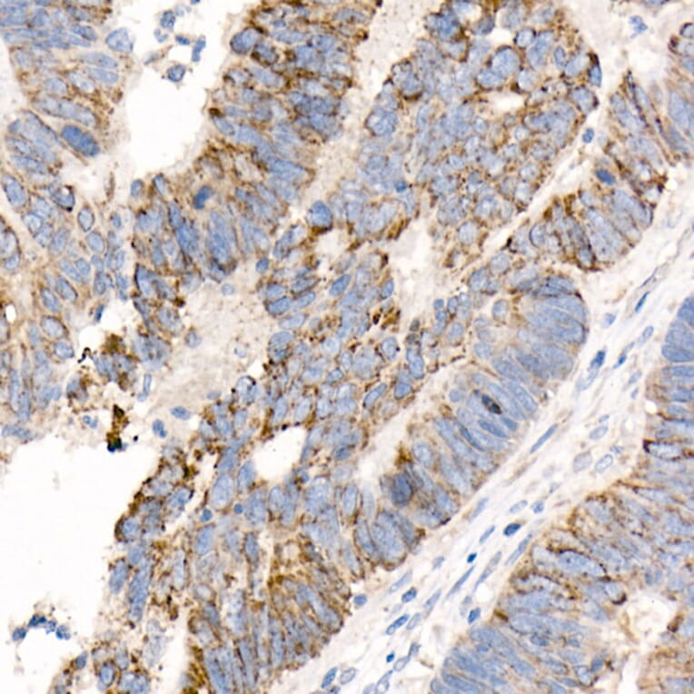 Immunohistochemistry - Anti-FACL4 Antibody [ARC53209] (A306923) - Antibodies.com