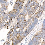 Immunohistochemistry - Anti-FACL4 Antibody [ARC53209] (A306923) - Antibodies.com