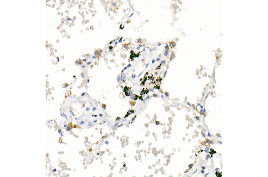 Immunohistochemistry - Anti-FACL4 Antibody [ARC53209] (A306923) - Antibodies.com