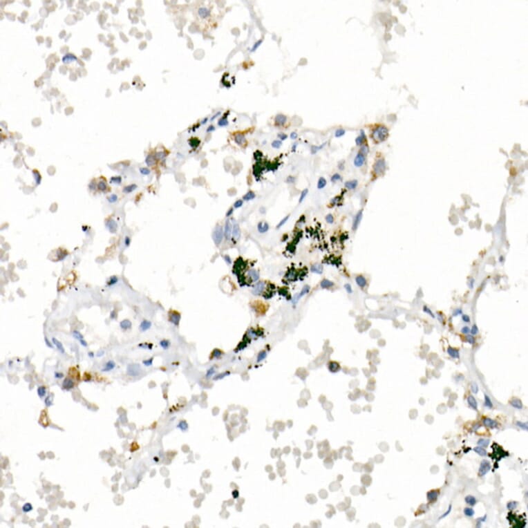 Immunohistochemistry - Anti-FACL4 Antibody [ARC53209] (A306923) - Antibodies.com