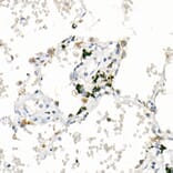 Immunohistochemistry - Anti-FACL4 Antibody [ARC53209] (A306923) - Antibodies.com