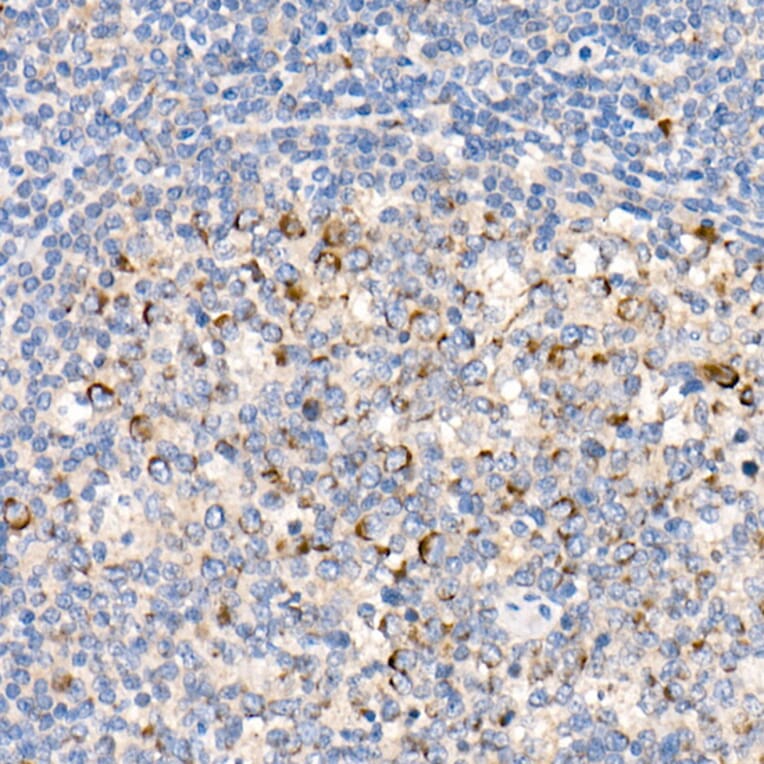 Immunohistochemistry - Anti-FACL4 Antibody [ARC53209] (A306923) - Antibodies.com
