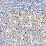 Immunohistochemistry - Anti-FACL4 Antibody [ARC53209] (A306923) - Antibodies.com