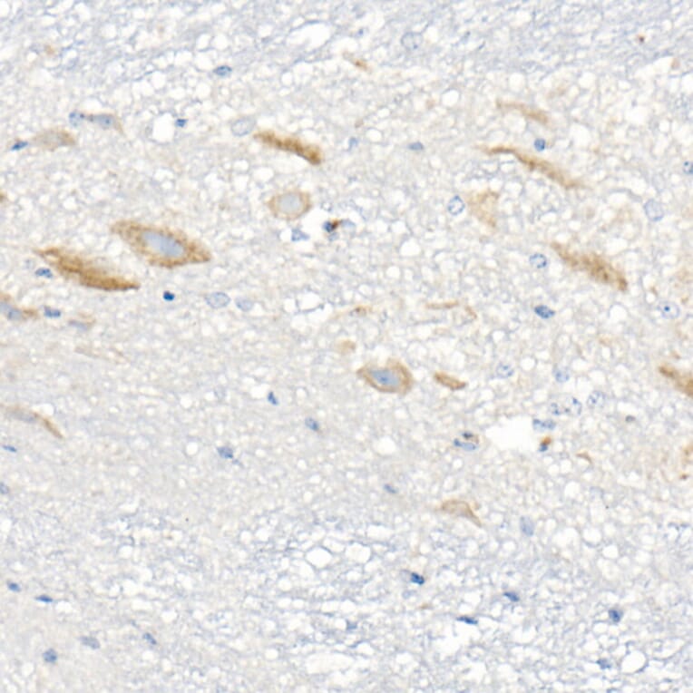 Immunohistochemistry - Anti-FACL4 Antibody [ARC53209] (A306923) - Antibodies.com