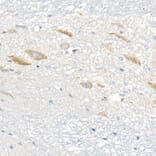 Immunohistochemistry - Anti-FACL4 Antibody [ARC53209] (A306923) - Antibodies.com