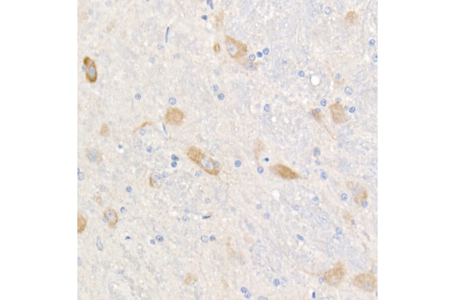 Immunohistochemistry - Anti-FACL4 Antibody [ARC53209] (A306923) - Antibodies.com