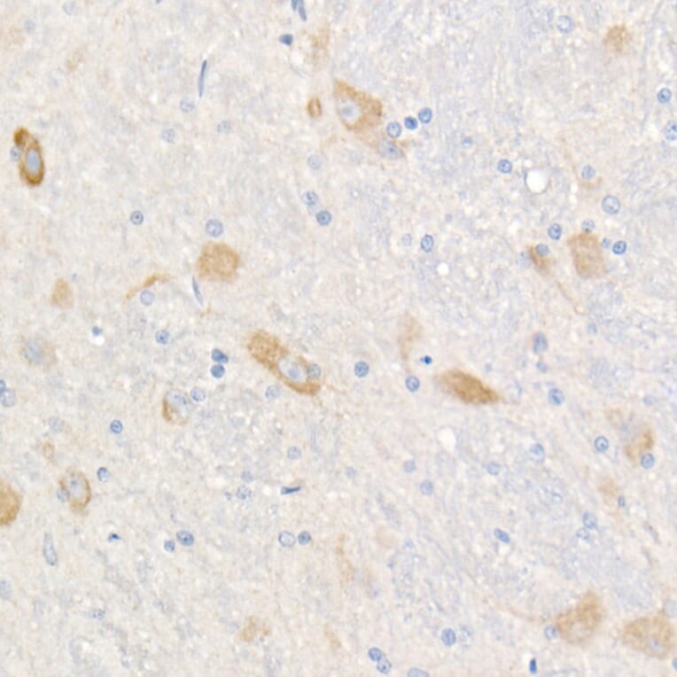 Immunohistochemistry - Anti-FACL4 Antibody [ARC53209] (A306923) - Antibodies.com