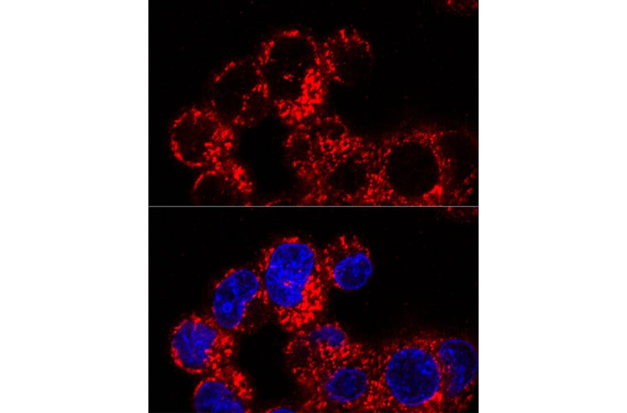 Immunofluorescence - Anti-FACL4 Antibody [ARC53209] (A306923) - Antibodies.com