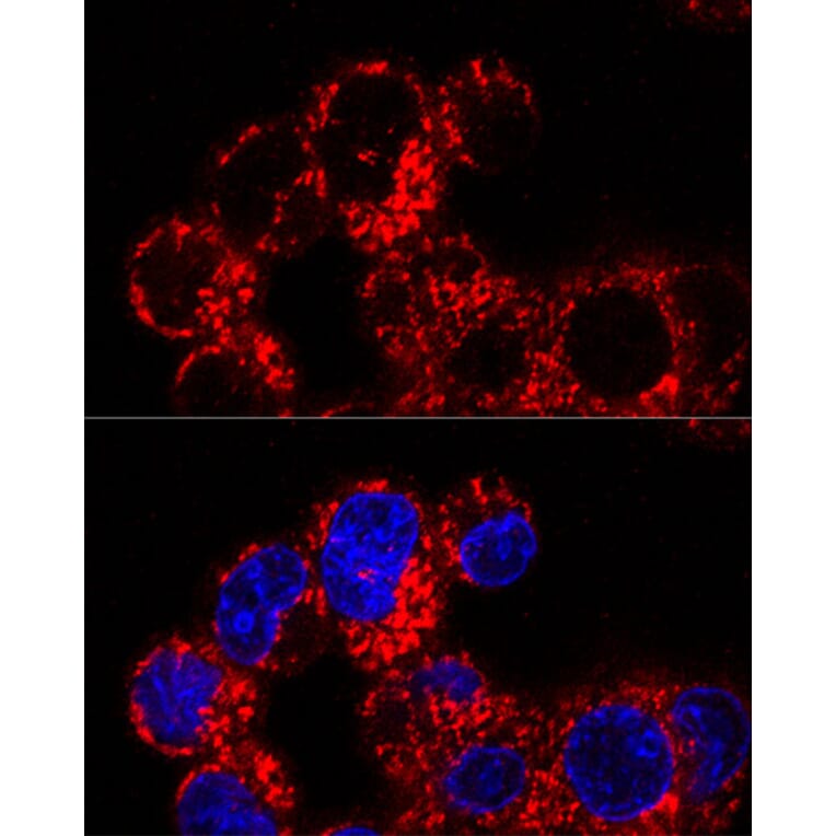 Immunofluorescence - Anti-FACL4 Antibody [ARC53209] (A306923) - Antibodies.com