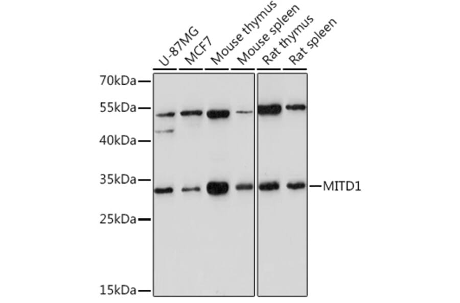 Western Blot - Anti-MITD1 Antibody (A306924) - Antibodies.com