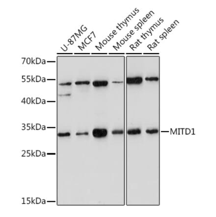 Western Blot - Anti-MITD1 Antibody (A306924) - Antibodies.com