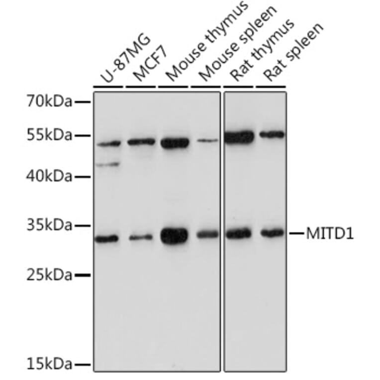 Western Blot - Anti-MITD1 Antibody (A306924) - Antibodies.com