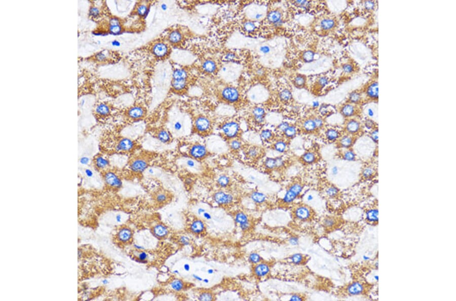 Immunohistochemistry - Anti-MITD1 Antibody (A306924) - Antibodies.com