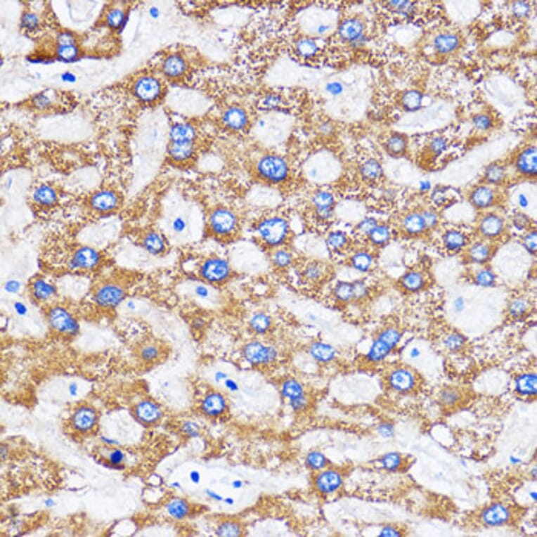 Immunohistochemistry - Anti-MITD1 Antibody (A306924) - Antibodies.com