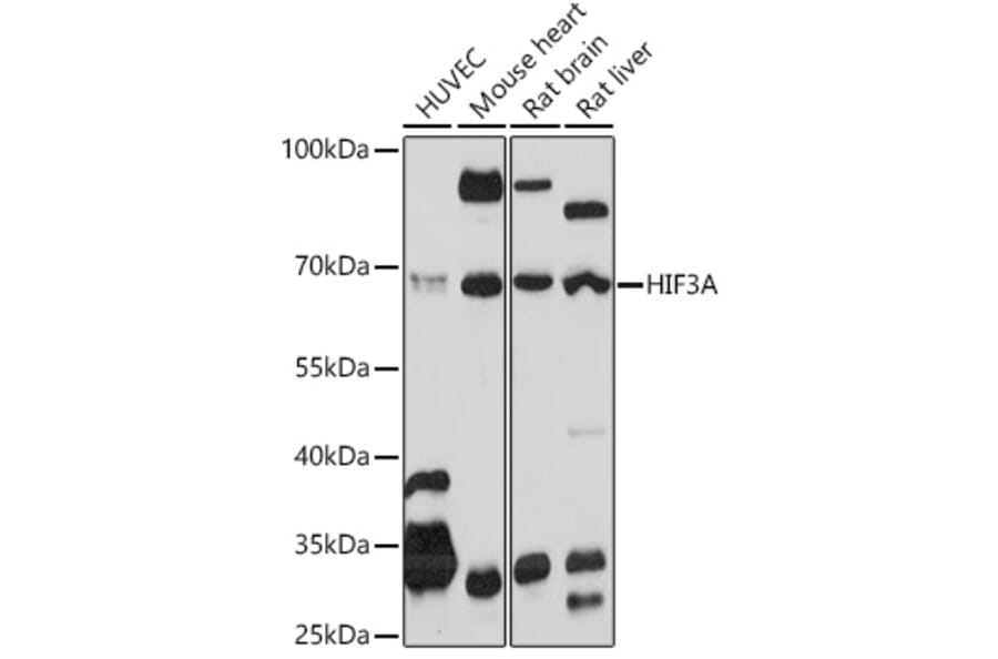 Western Blot - Anti-HIF3 alpha/IPAS Antibody (A306926) - Antibodies.com