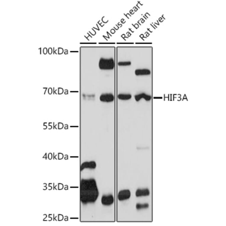 Western Blot - Anti-HIF3 alpha/IPAS Antibody (A306926) - Antibodies.com