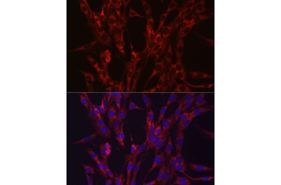 Immunofluorescence - Anti-HIF3 alpha/IPAS Antibody (A306926) - Antibodies.com