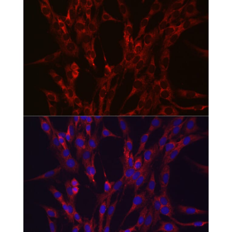 Immunofluorescence - Anti-HIF3 alpha/IPAS Antibody (A306926) - Antibodies.com