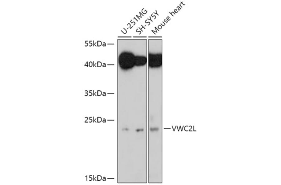 Western Blot - Anti-VWC2L Antibody (A306927) - Antibodies.com