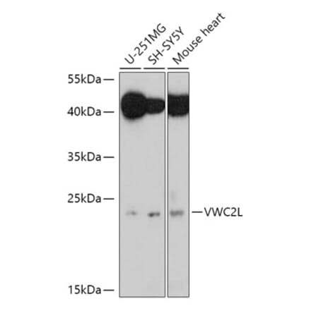 Western Blot - Anti-VWC2L Antibody (A306927) - Antibodies.com