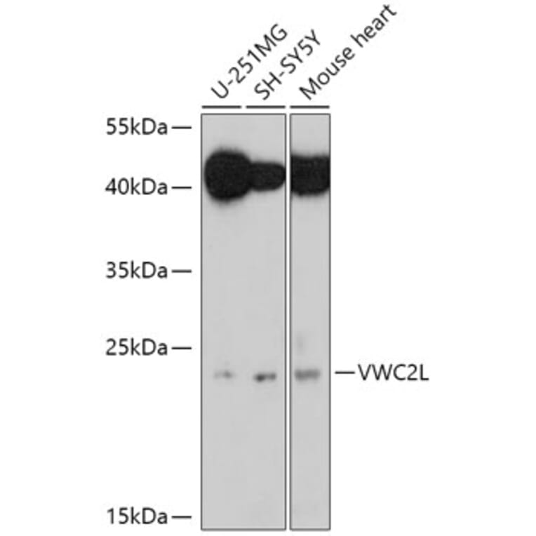 Western Blot - Anti-VWC2L Antibody (A306927) - Antibodies.com