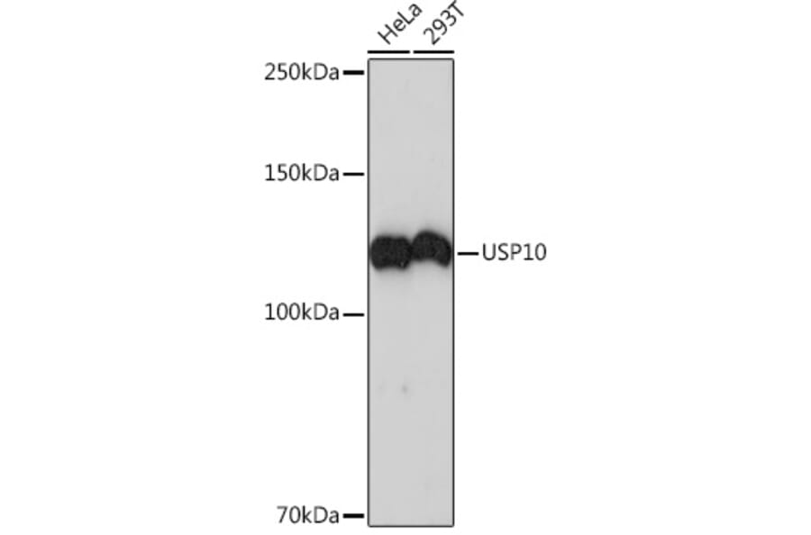 Western Blot - Anti-USP10 Antibody [ARC1015] (A306928) - Antibodies.com