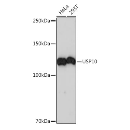 Western Blot - Anti-USP10 Antibody [ARC1015] (A306928) - Antibodies.com