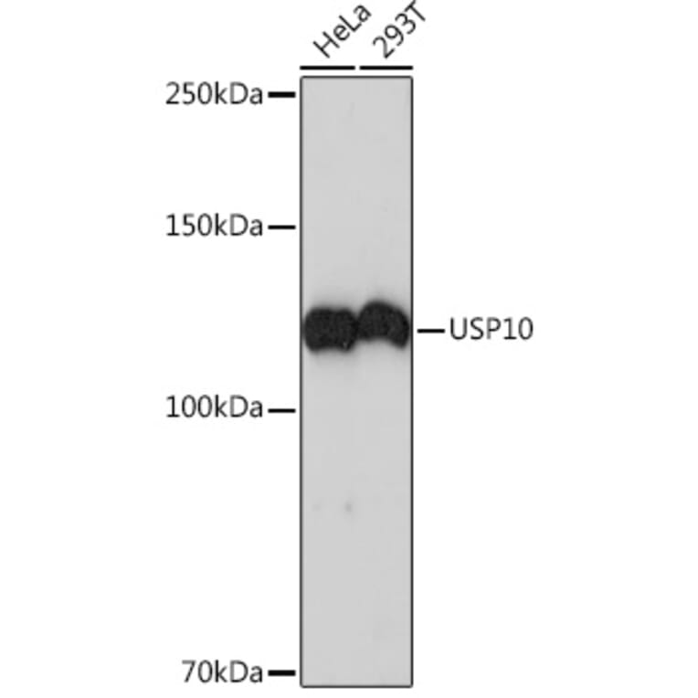 Western Blot - Anti-USP10 Antibody [ARC1015] (A306928) - Antibodies.com