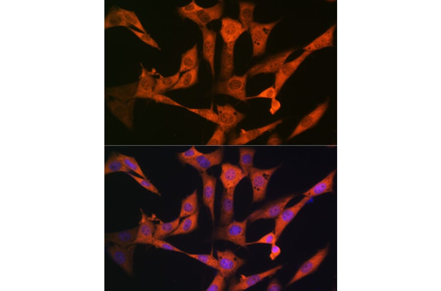 Immunofluorescence - Anti-USP10 Antibody [ARC1015] (A306928) - Antibodies.com