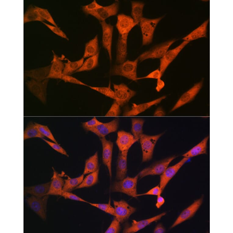 Immunofluorescence - Anti-USP10 Antibody [ARC1015] (A306928) - Antibodies.com