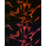 Immunofluorescence - Anti-USP10 Antibody [ARC1015] (A306928) - Antibodies.com