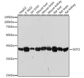Western Blot - Anti-FABP-1 Antibody [ARC2405] (A306930) - Antibodies.com