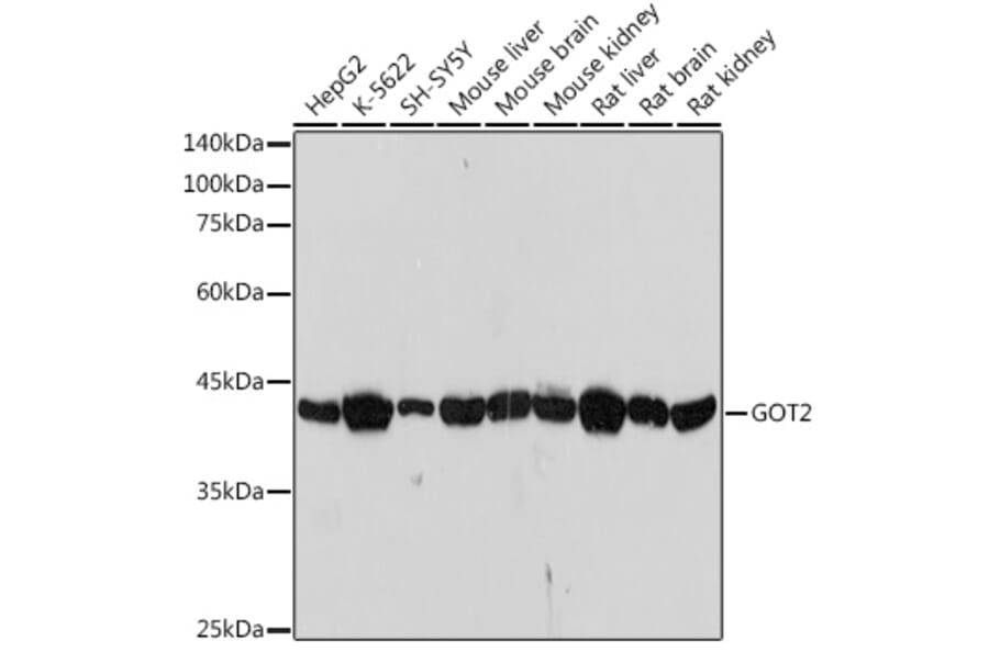 Western Blot - Anti-FABP-1 Antibody [ARC2405] (A306930) - Antibodies.com