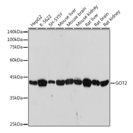 Western Blot - Anti-FABP-1 Antibody [ARC2405] (A306930) - Antibodies.com