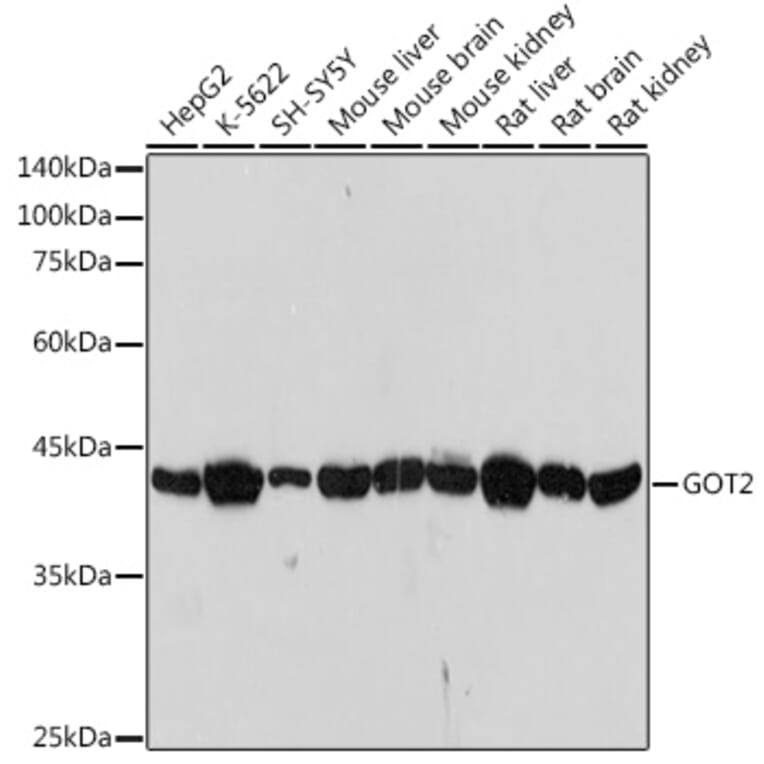 Western Blot - Anti-FABP-1 Antibody [ARC2405] (A306930) - Antibodies.com