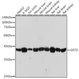Western Blot - Anti-FABP-1 Antibody [ARC2405] (A306930) - Antibodies.com
