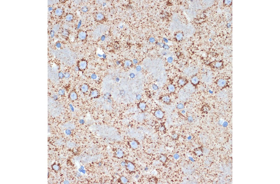 Immunohistochemistry - Anti-FABP-1 Antibody [ARC2405] (A306930) - Antibodies.com