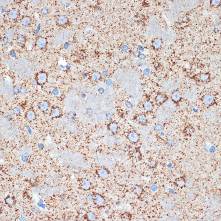 Immunohistochemistry - Anti-FABP-1 Antibody [ARC2405] (A306930) - Antibodies.com