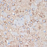 Immunohistochemistry - Anti-FABP-1 Antibody [ARC2405] (A306930) - Antibodies.com