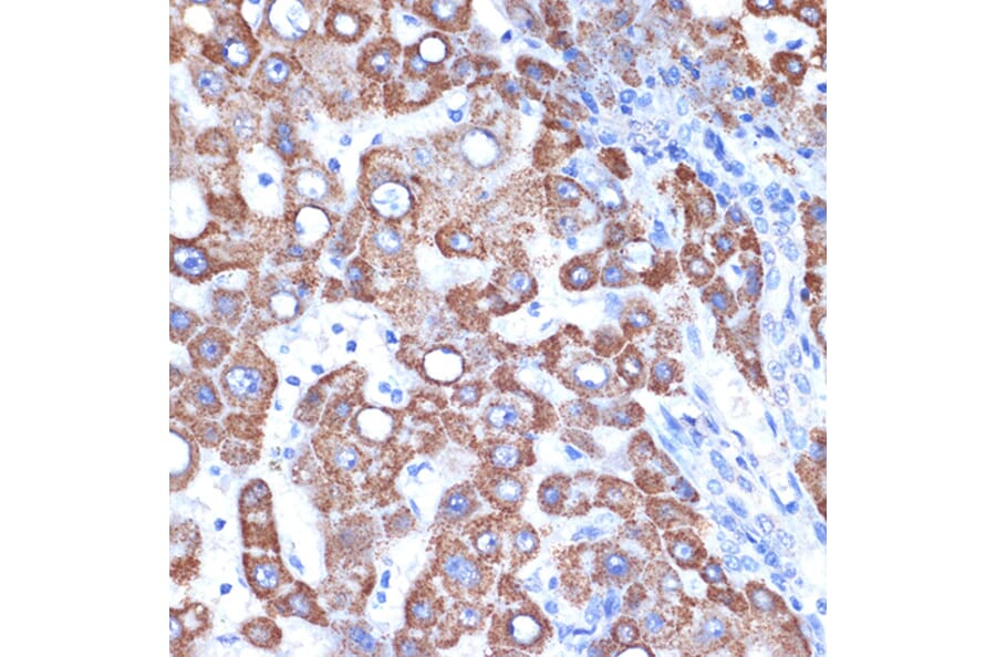 Immunohistochemistry - Anti-FABP-1 Antibody [ARC2405] (A306930) - Antibodies.com