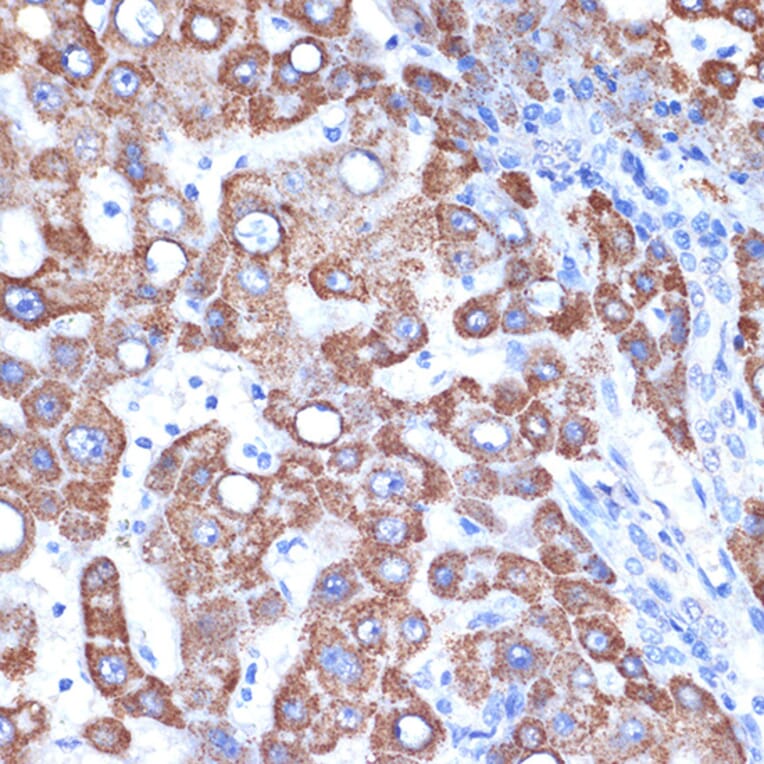 Immunohistochemistry - Anti-FABP-1 Antibody [ARC2405] (A306930) - Antibodies.com
