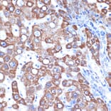Immunohistochemistry - Anti-FABP-1 Antibody [ARC2405] (A306930) - Antibodies.com
