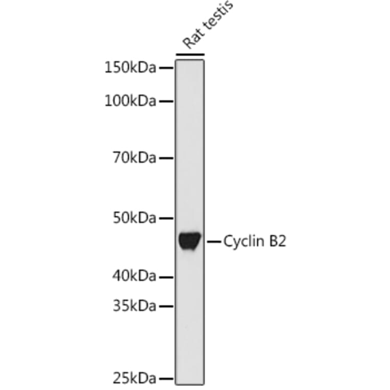 Western Blot - Anti-Cyclin B2/CCNB2 Antibody [ARC1435] (A306931) - Antibodies.com