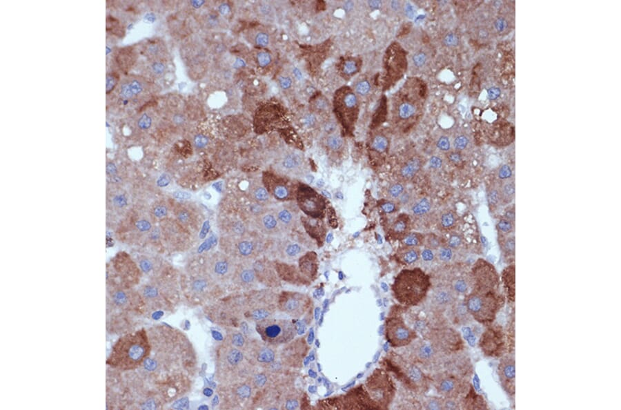 Immunohistochemistry - Anti-Cyclin B2/CCNB2 Antibody [ARC1435] (A306931) - Antibodies.com